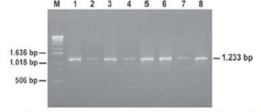 Molecular Genotyping of HBV by using Nested PCR-RFLP among Hepatitis B Patients in Daerah Istimewa Yogyakarta Province and Surrounding Area (Aris Haryanto et al.)